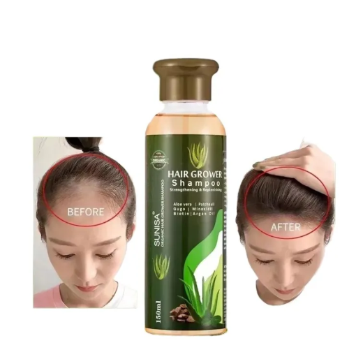 Sunisa - Hair Growth Shampoo